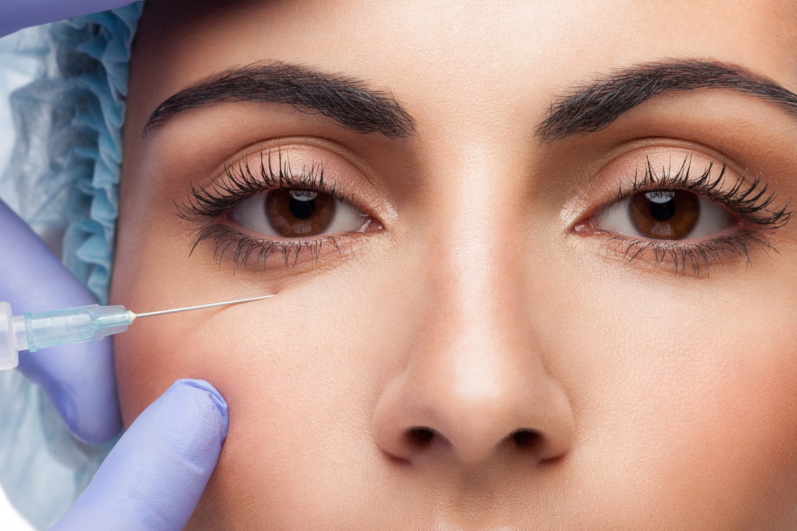 3 Causes of “Heavy Eyelids” – Early Signs of Aging