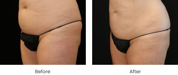 hormone harmony weight loss reviews The Hormone Reset Kit