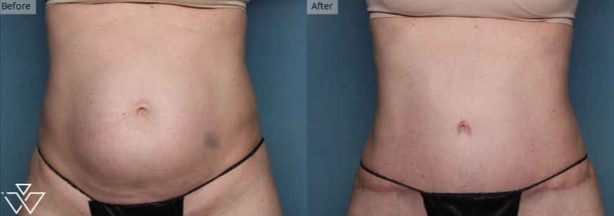 Plastic Surgery, Long Beach, South Bay