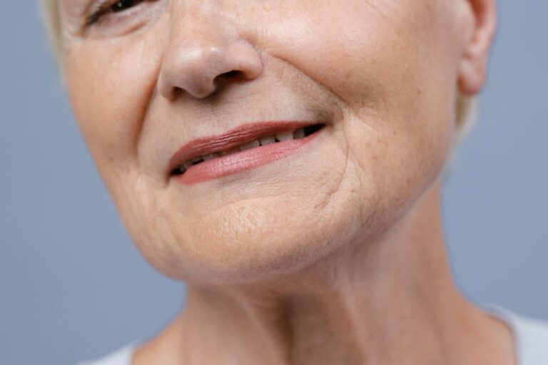 facelift